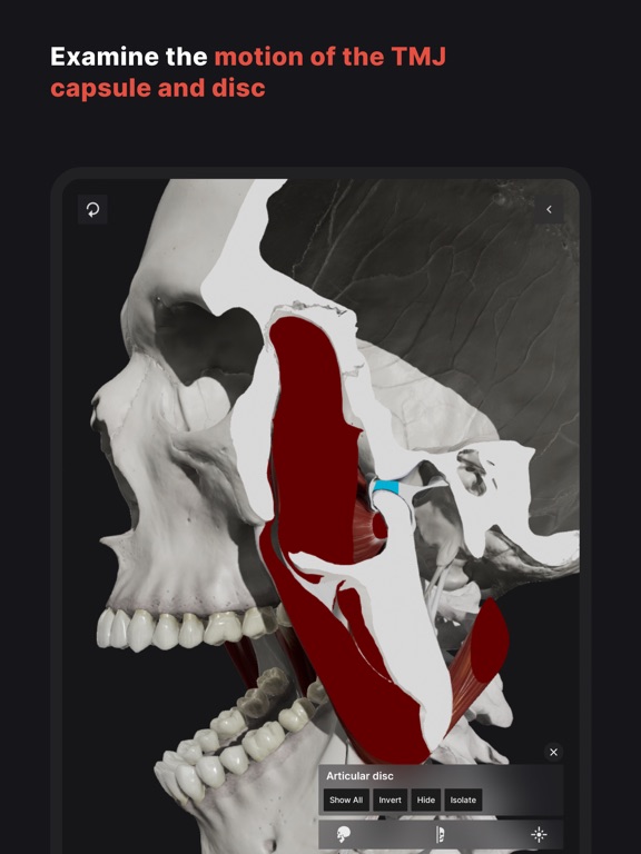 Skull, Teeth & TMJのおすすめ画像6