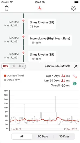 Game screenshot ECG+ Analyzer for QT/QTc & HRV apk