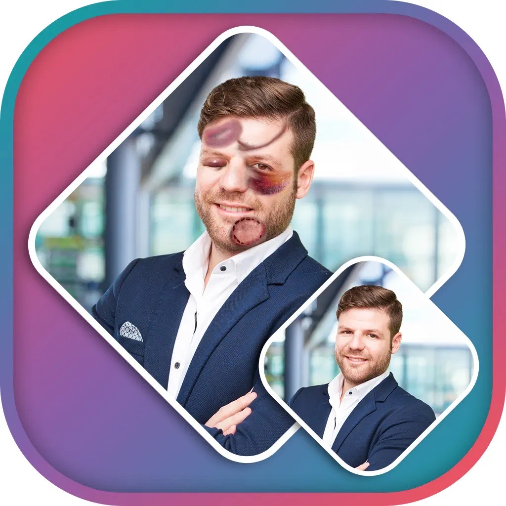 Get Injury Photo Editor for iOS, iPhone, iPad Aso Report