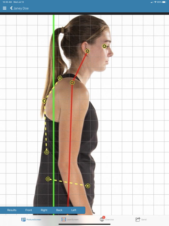 PostureScreen Mobile