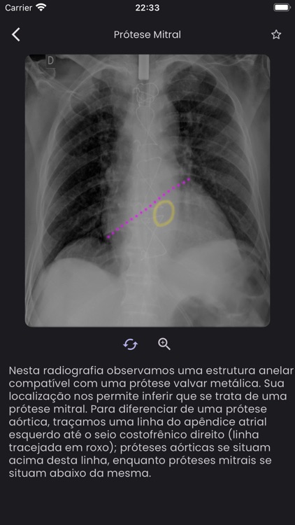 TóraxApp screenshot-4