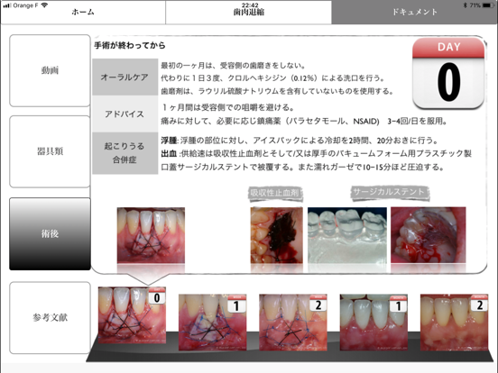 iMuco Récessions gingivalesのおすすめ画像5