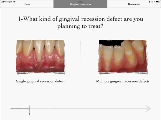 iMuco Gingival recessions iPad screenshot