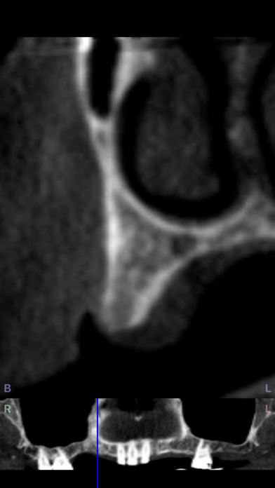 Dental CT View Screenshot