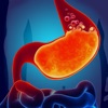 Gas Trouble in Stomach Acidity icon