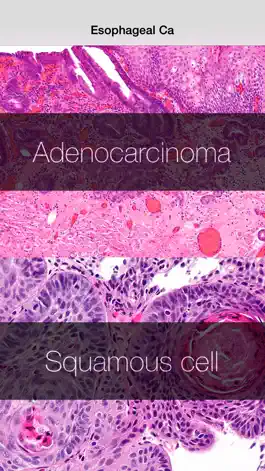 Game screenshot Esophageal Cancer Stage mod apk