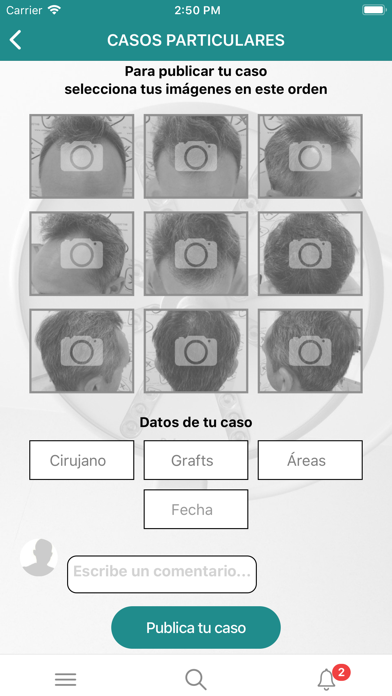 Injerto Capilar Screenshot
