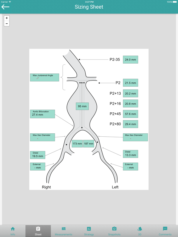 EndoSizeMe iPad screenshot