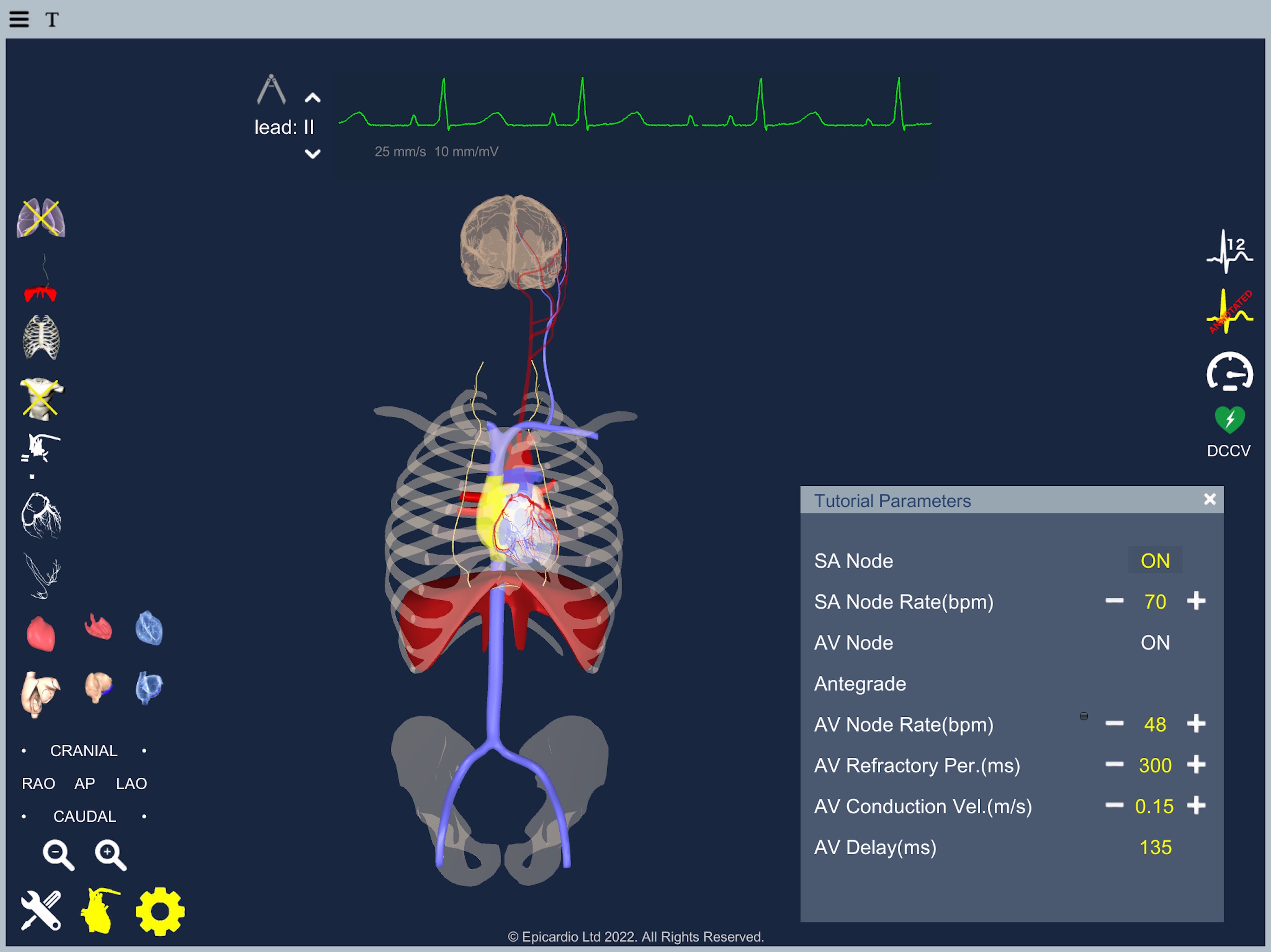 Atrial Fibrillationのおすすめ画像10