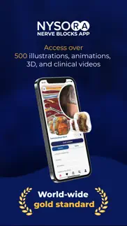 nysora nerve blocks iphone screenshot 1