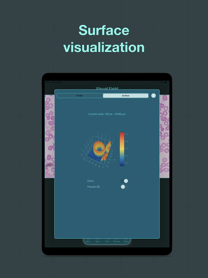 XScopy μPhoto Elements