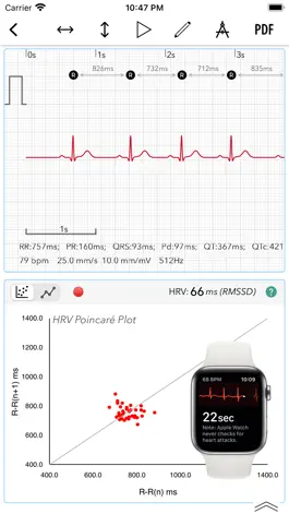 Game screenshot ECG+ Analyzer for QT/QTc & HRV mod apk