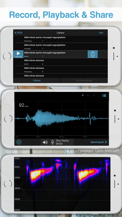 Screenshot #2 pour E-Stéthoscope et Auscultation