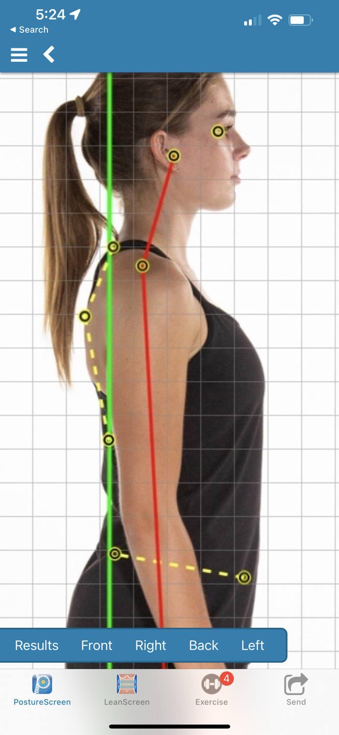 PostureScreen Mobile