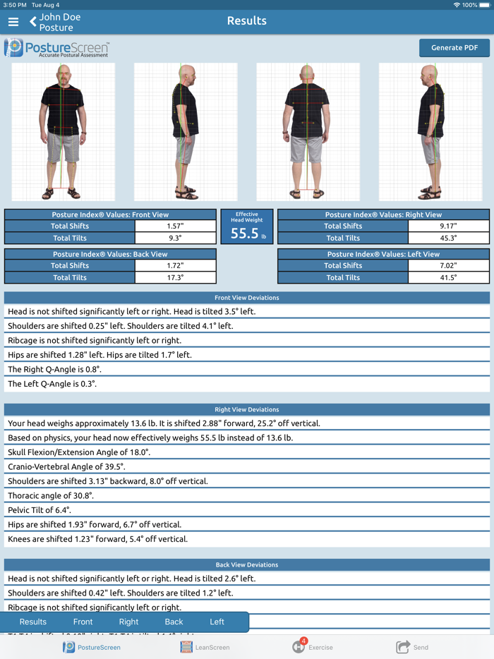 PostureScreen Mobile