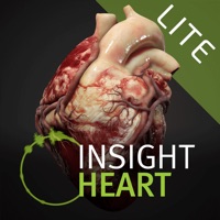INSIGHT HEART Lite app not working? crashes or has problems?