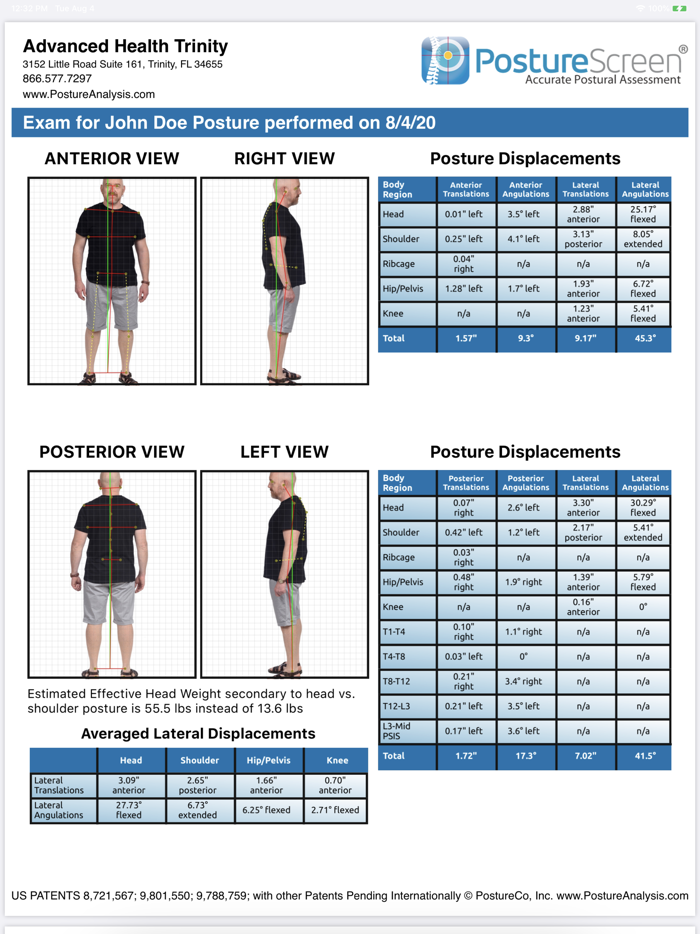 PostureScreen Mobile