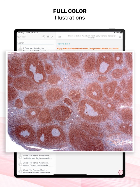 Screenshot #6 pour Williams Manual of Hematology
