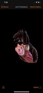 CardioSmart Heart Explorer screenshot #5 for iPhone