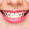 Icon Fake Braces Face Photo Editor