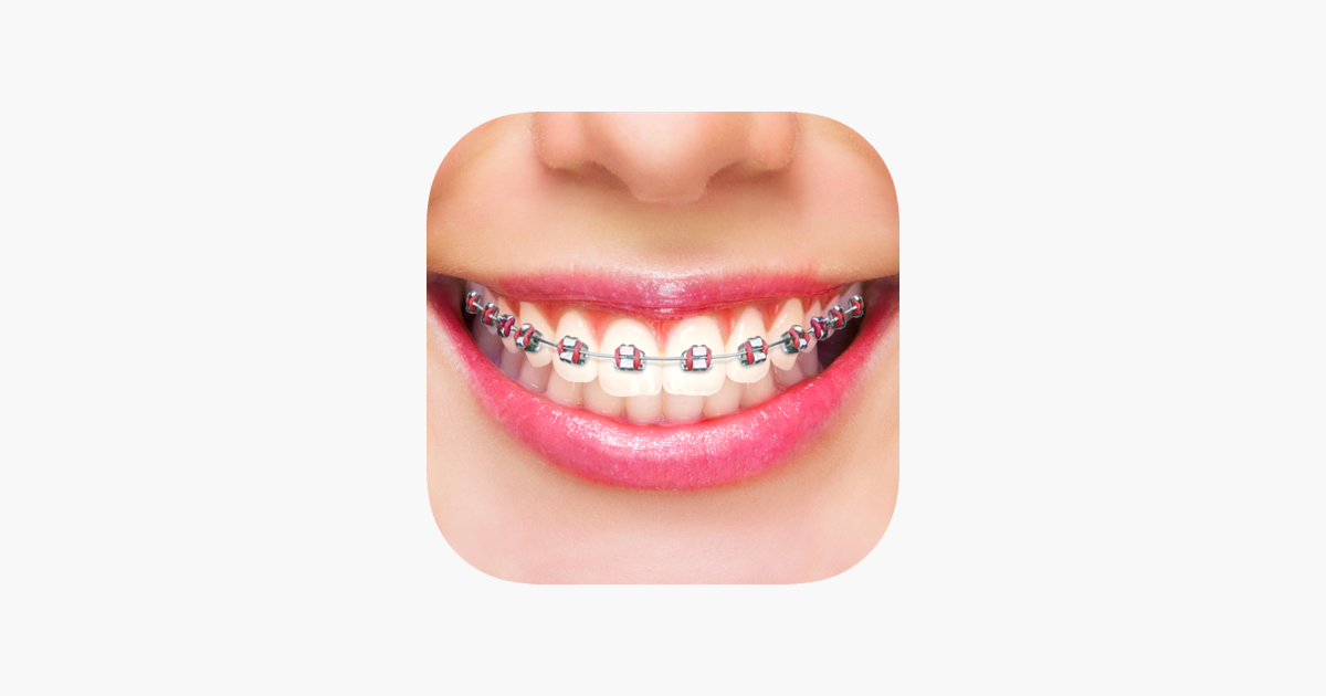 Bretelle denti editor di foto su App Store