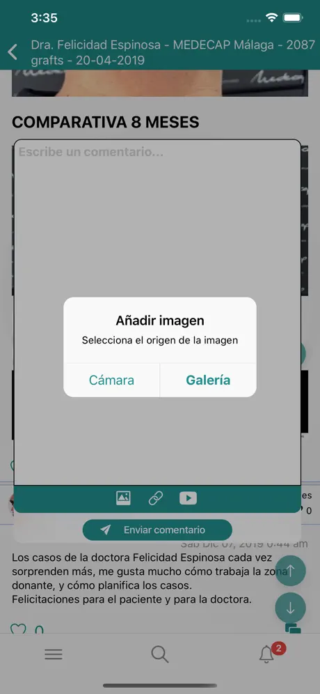 Injerto Capilar