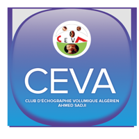 CEVA