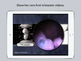 Game screenshot Baby's Story Pregnancy Guide apk