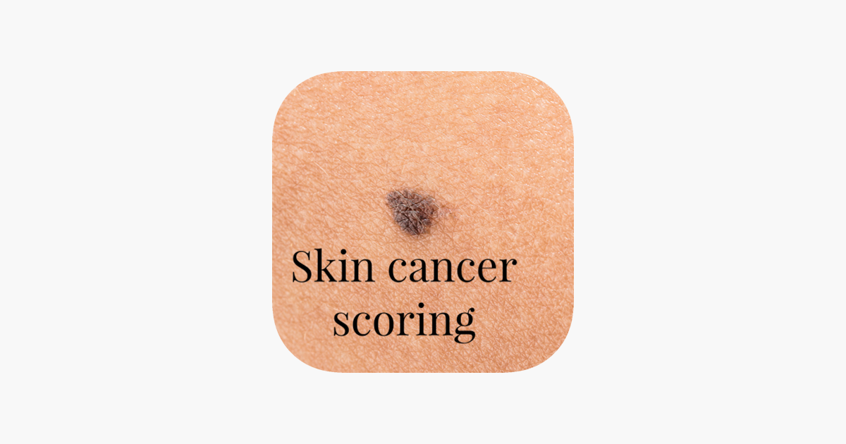 skin-cancer-detection