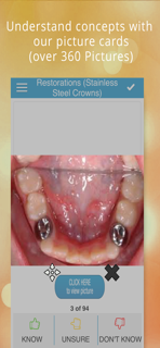 Pediatric Dentistry Cram Cards screenshot 2