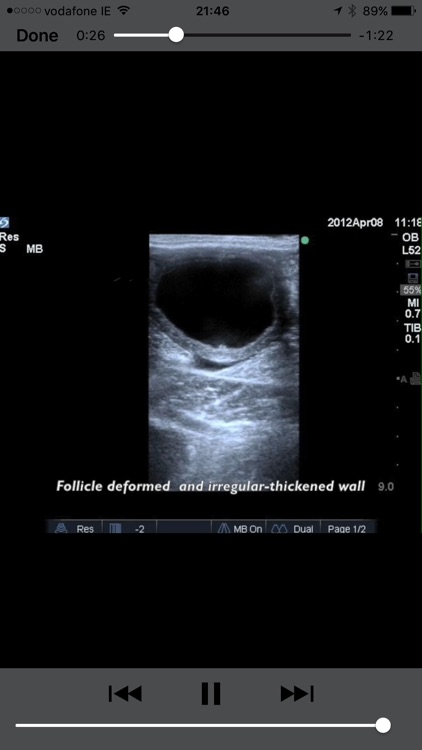 Equine Reproductive Ultrasound