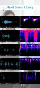 E-Stethoscope & Auscultation screenshot #2 for iPhone