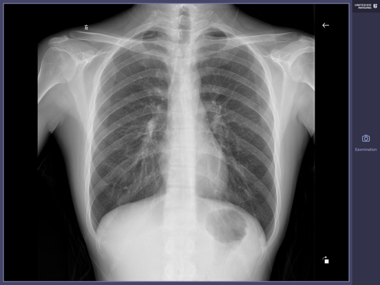 Screenshot #5 pour U-eye