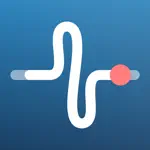 Tinnilog - Tinnitus Tracker App Positive Reviews