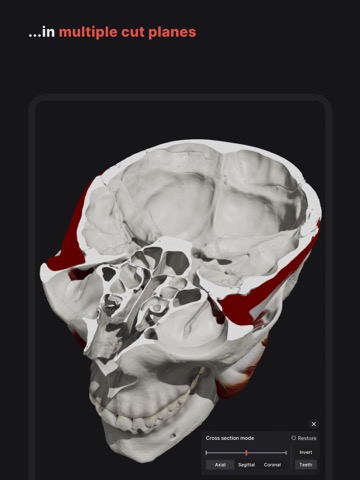 Skull, Teeth & TMJのおすすめ画像5