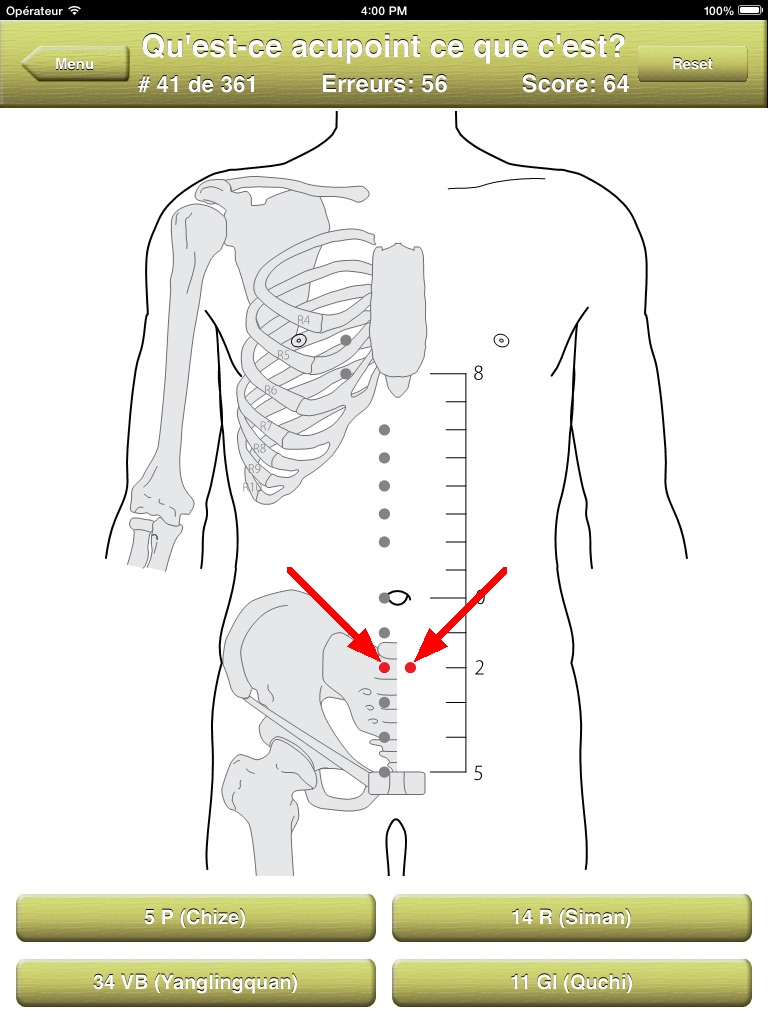 Acupoints Location Quiz screenshot 4
