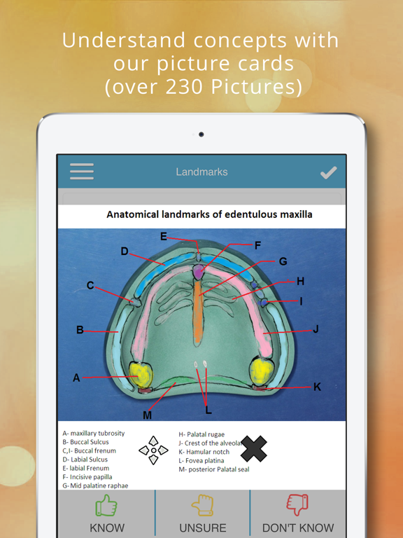 Screenshot #5 pour Prosthodontics Cram Cards