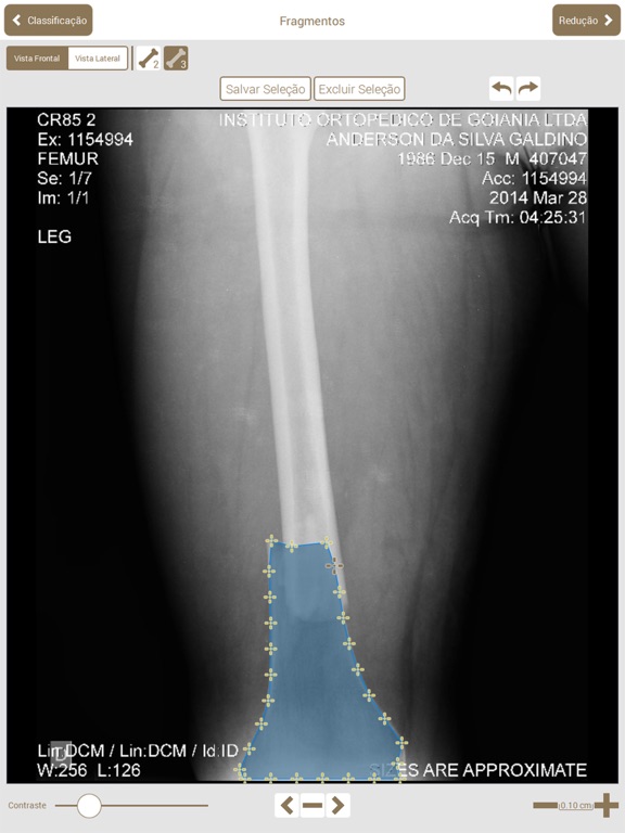 Osteotraumaのおすすめ画像3