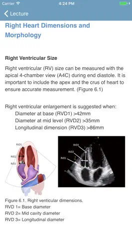 Game screenshot BASIC - Transthoracic Echocard apk