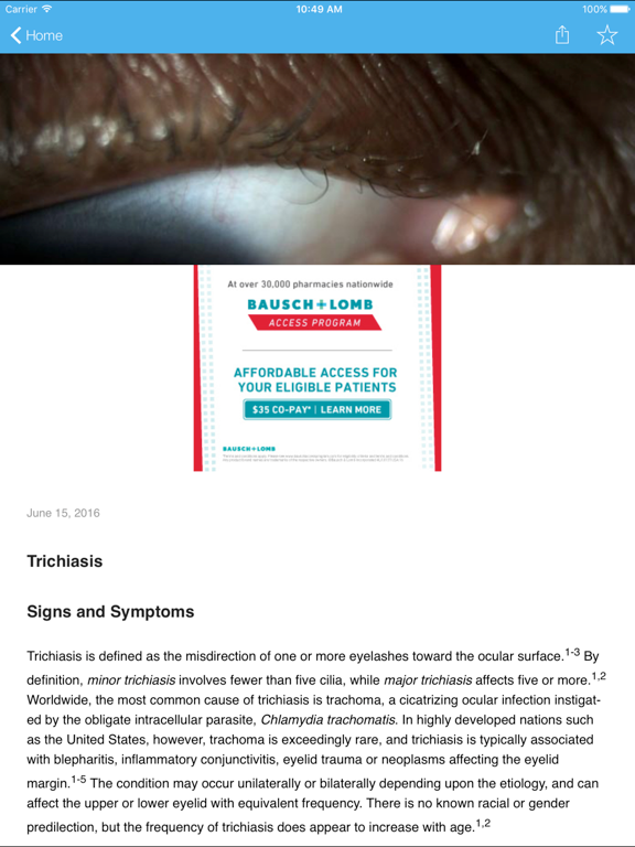 Ocular Disease Handbook iPad screenshot 4 - Medical app