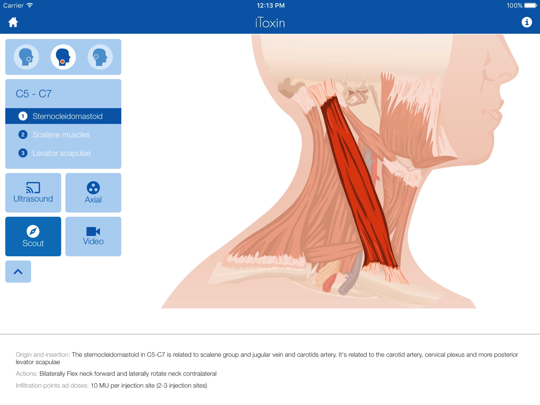 iToxin screenshot 4