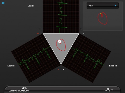 Craytonium ECG screenshot 3