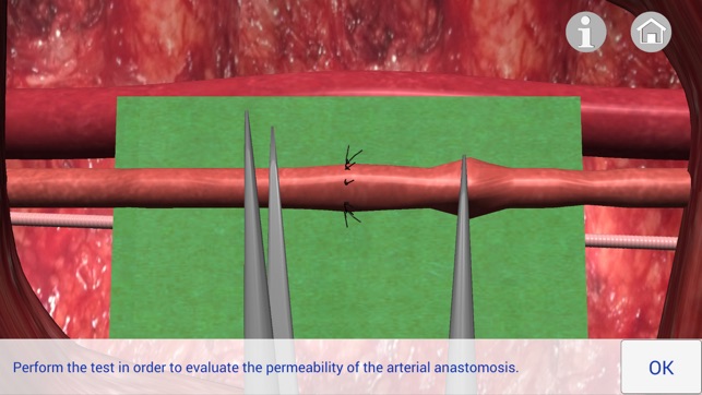 Microsurgery 3D (Ad Version)(圖3)-速報App