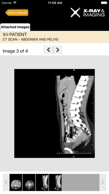 XRI Patient Access screenshot-4