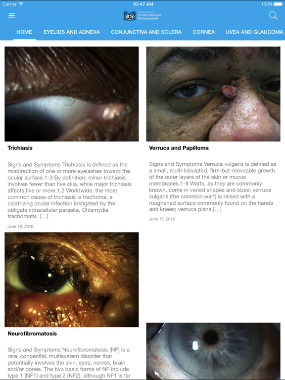 Screenshot #5 pour Ocular Disease Handbook