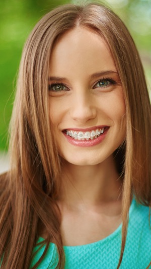 Braces on teeth – Photo editor orthodontic(圖2)-速報App