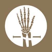 Osteotrauma