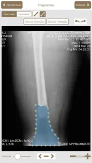 osteotrauma problems & solutions and troubleshooting guide - 1