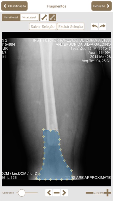 Osteotraumaのおすすめ画像3