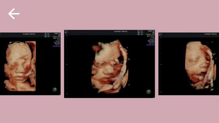 eCodadys My Baby 5D-4D